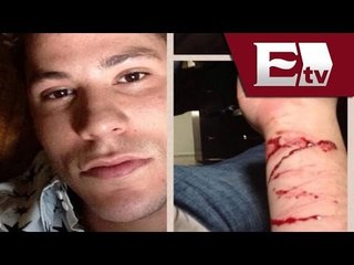 Intento de suicidio del cantante Christian Chavez (Imágenes) / Función