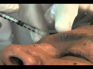 Uso de botox cada vez mas recurrente entre los hombres