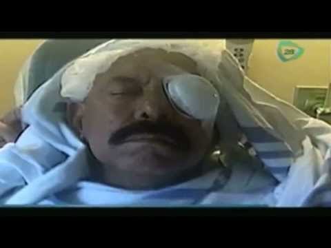 Oscar D'León podría perder un ojo /cantante de salsa venezolano Oscar D'León sufre accidente