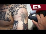 Clínica de Denver ayuda a exconvictos a reiniciar su vida removiendo tatuajes / Andrea Newman