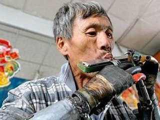 Hombre se construye sus propios brazos biónicos