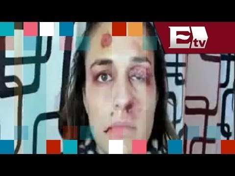 Selfies diarios de mujeres para exponer la violencia de género/ Entre Mujeres