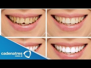 Relación entre salud dental y riesgo cardiovascular