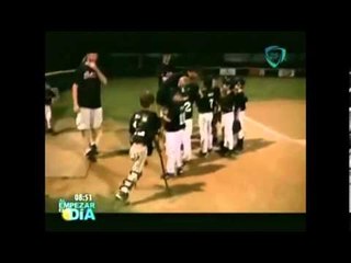Inspiradora historia de Adam, niño con discapacidad que juega Béisbol