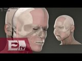 Realizarán el primer trasplante de cara/ Excelsior en la media con Atalo Mata
