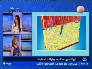 tendances نسمة : حقن الدهون: مخاطره ..و فوائده الجمالية مع الضيفة اشراف داود