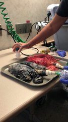 Une infirmière explique ce que le tabagisme fait chaque jour à vos poumons