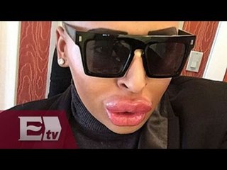 Quería ser como Kim Kardashian y terminó como El Pato Lucas / Excélsior Informa