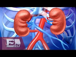 ¿Qué es una enfermedad renal? / Gloria Contreras