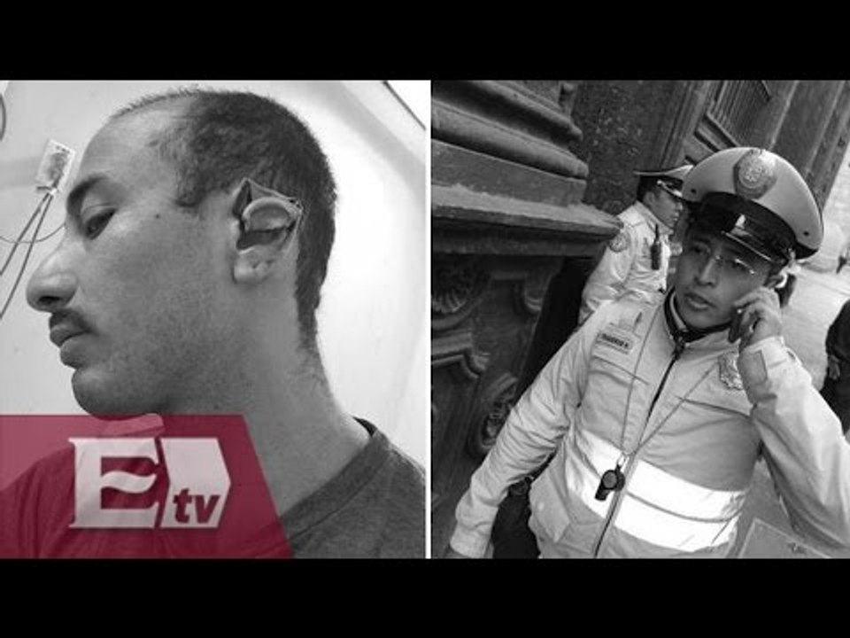 SSPDF indemnizará a ciudadano que sufrió mutilación de oreja/ Comunidad