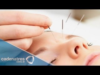 La aculpuntura emocional para dolores físicos