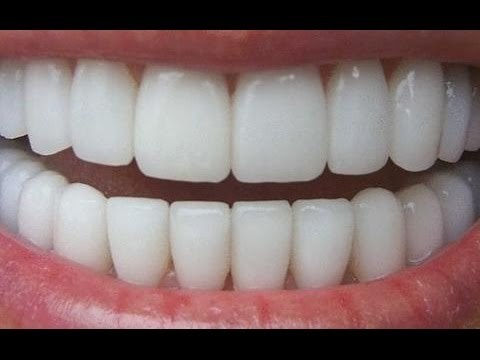 ¿Cómo cuidar los dientes?