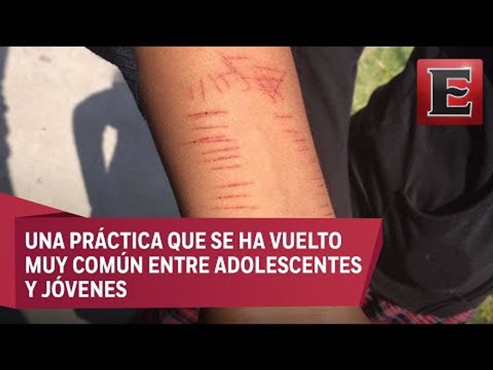 Curting, ¿el camino rumbo al suicidio?