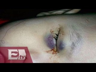 Sonora: Negligencia médica deja a bebé ciego / Titulares de la Noche