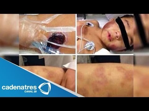 Denuncian maltrato a menor de 5 años en el Edomex /#SalvemosAOwen