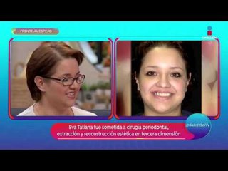 Ella tenía miedo a sonreír