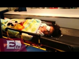 Niegan atención médica a menor mordido por perro en Ixtapaluca / Ingrid Barrera