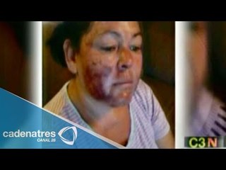 Agua tóxica del río de Sonora causa quemaduras a mujer