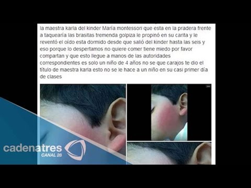 Maestra golpea y revienta oído de un niño de cuatro años en Guanajuato