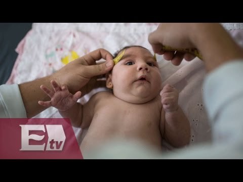 Brasil: Más de cuatro mil bebés afectados con el virus Zika / Paola Virrueta