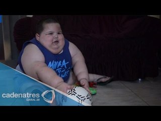¡Increíble! Niño de 3 años pesa más de 70 kilos