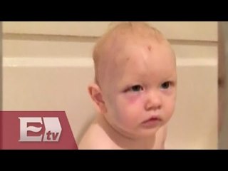 Indignante: en EU niñera golpea a bebé y no será juzgada / Martín Espinosa