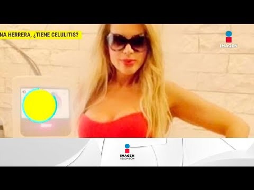 ¡Lorena Herrera responde a las críticas sobre imperfecciones en su cuerpo! | De Primera Mano