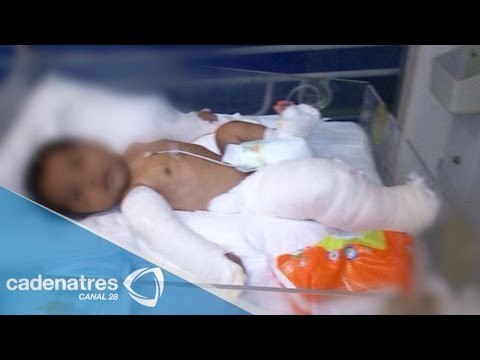 Padres fracturan brazos y pierna de un bebé de dos meses