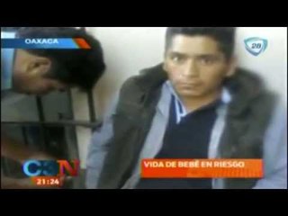Golpea a su hija de 8 meses y le fractura el cráneo