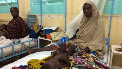 Niger: le fléau de la malnutrition infantile