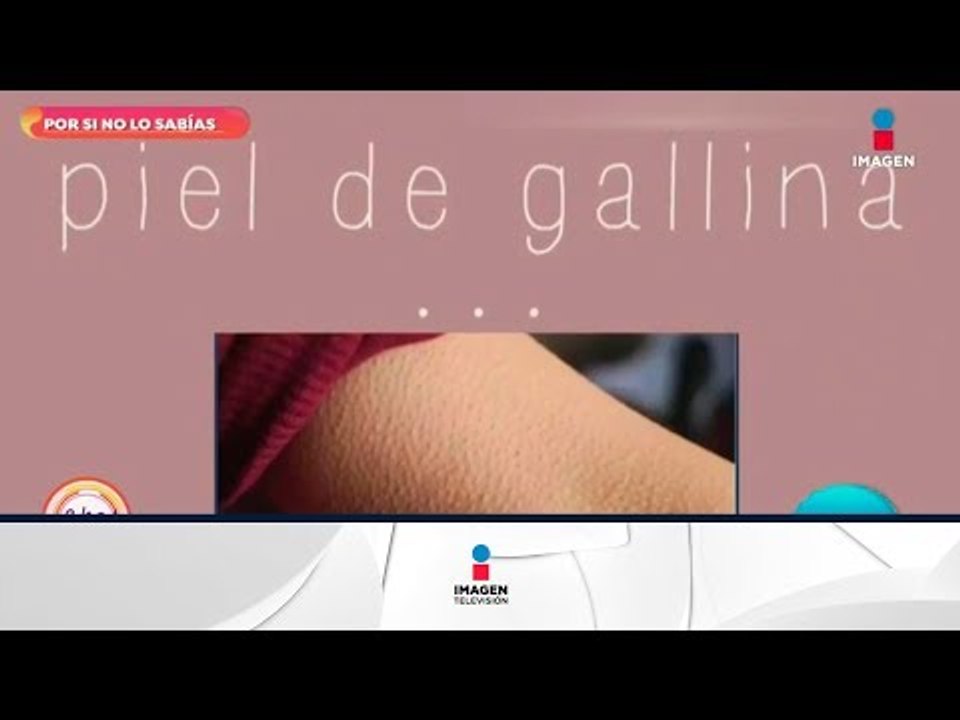 Por si no lo sabías: ¿por qué se pone la piel de gallina? | Sale el Sol