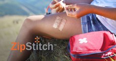 ZipStitch, la solución para cerrar heridas en cuestión de segundos