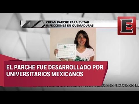 Crean parche para evitar infecciones en quemaduras