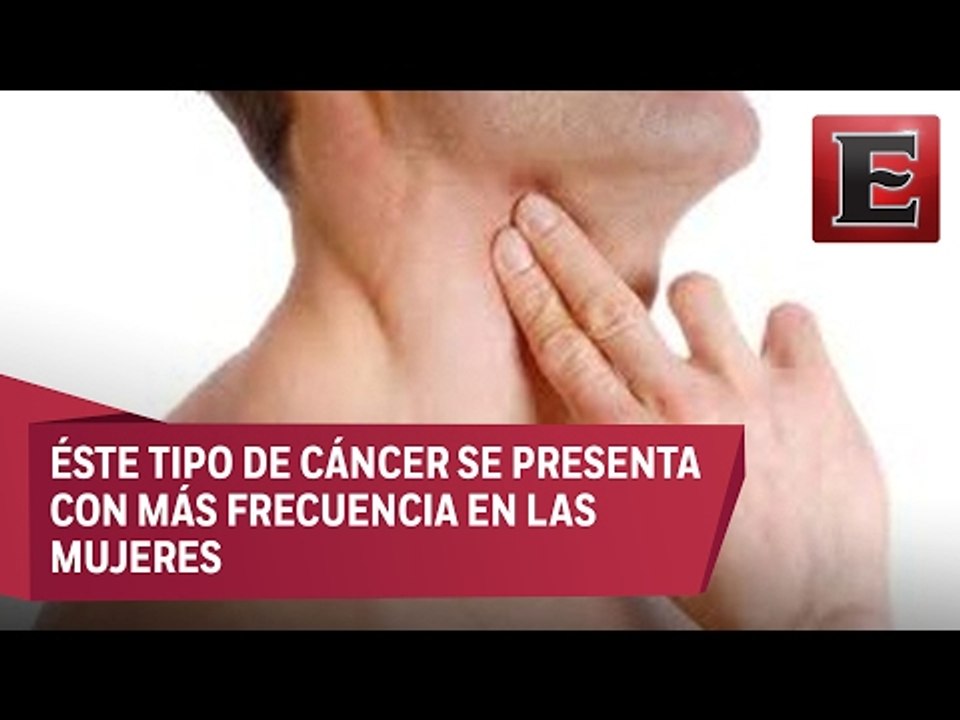 Causas y síntomas del cáncer de tiroides