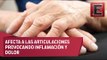 La artritis reumatoide: Causas, síntomas y tratamiento