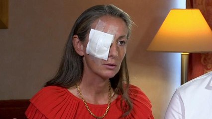 Έχασε το μάτι της σε αγώνα γκολφ του Ryder Cup