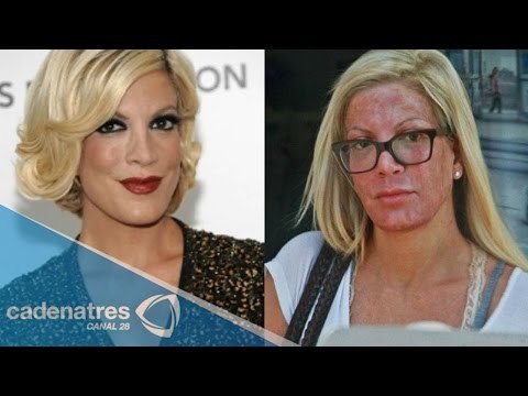 El desfigurado rostro que dejó a Tori Spelling un tratamiento de belleza