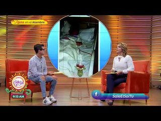 ¡Belinda comparte la historia de su cirugía en redes sociales! | Sale el Sol