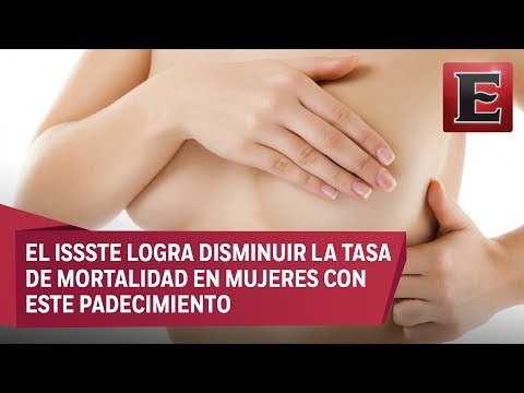 Detección oportuna de cáncer de mama amplía posibilidad de supervivencia