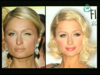 Lista de famosas adictas al "Botox" / List of famous addicted to "Botox"