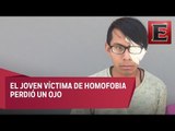 Investigan a policías de Huehuetoca por homofobia