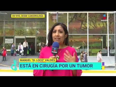 Enlace a Cancerología para conocer los detalles de la cirugía de 'El Loco' Valdés|De Primera Mano