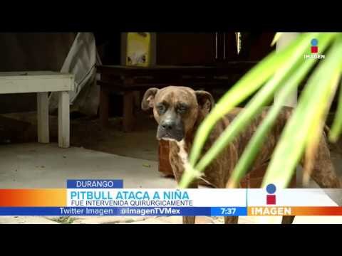 Otra niña es atacada por pitbull | Noticias con Francisco Zea