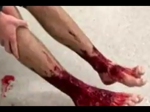 Descubren bichos marinos que comen carne humana | Noticias con Yuriria Sierra