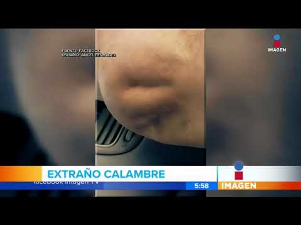 Video de extraño calambre en la pierna se hace viral | Noticias con Francisco Zea