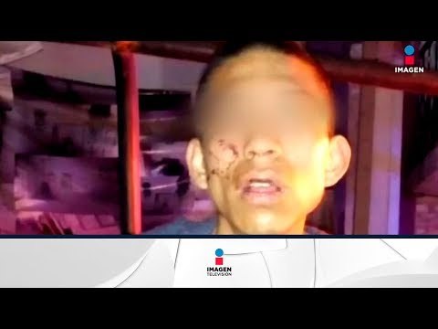 Marco Antonio podría tener daño neurológico | Noticias con Yuriria Sierra