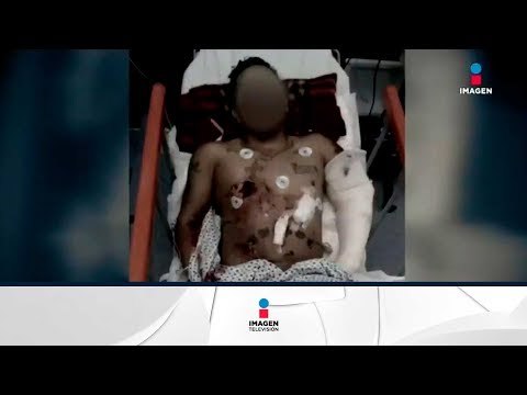 En tan sólo 14 segundos un comando entró a un hospital de Guanajuato | Noticias con Ciro