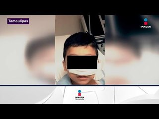 ¿Qué pasó con el niño que recibió una bala en su cabeza? | Noticias con Yuriria Sierra