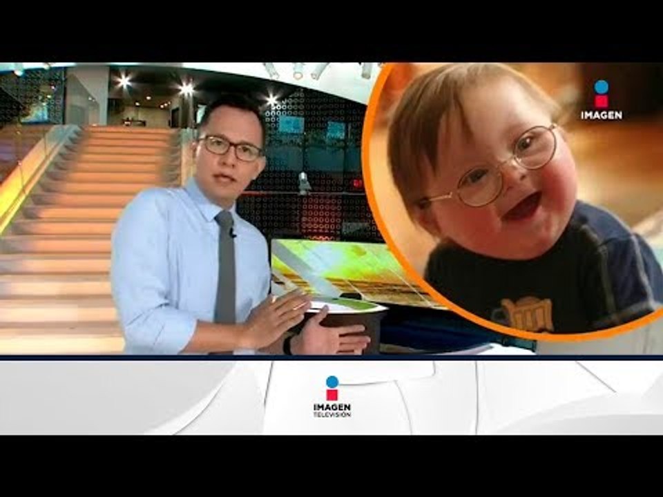 ¿Qué es el síndrome de Down? | Noticias con Francisco Zea