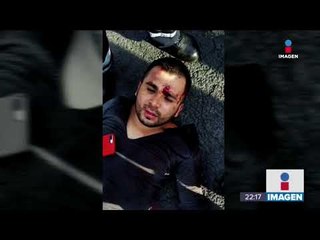 El cuerpo abandonado en el Viaducto era de un colombiano secuestrado | Noticias con Ciro